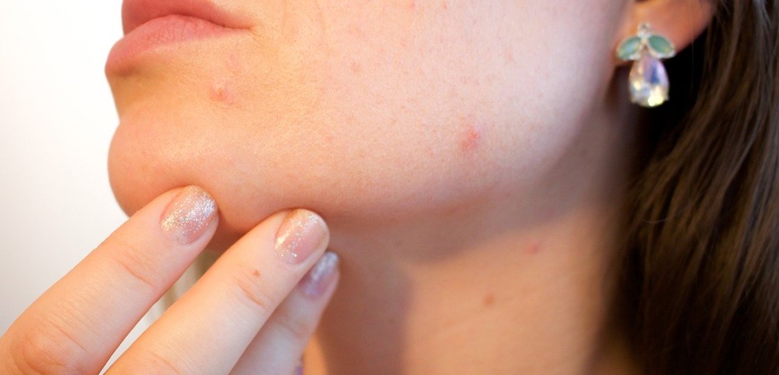 アトピー性皮膚炎」の最新治療とは？幹細胞を使った皮膚疾患治療を解説！ | 国際幹細胞普及機構