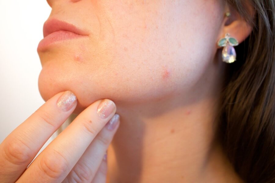「アトピー性皮膚炎」の最新治療とは？幹細胞を使った皮膚疾患治療を解説！