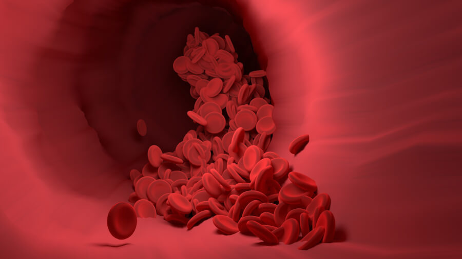 動脈硬化と虚血性疾患とは？幹細胞の治療法を解説！