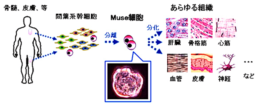 Muse細胞とは 急性心筋梗塞 脳梗塞 脊髄損傷 表皮水疱症患者への臨床試験も解説 国際幹細胞普及機構
