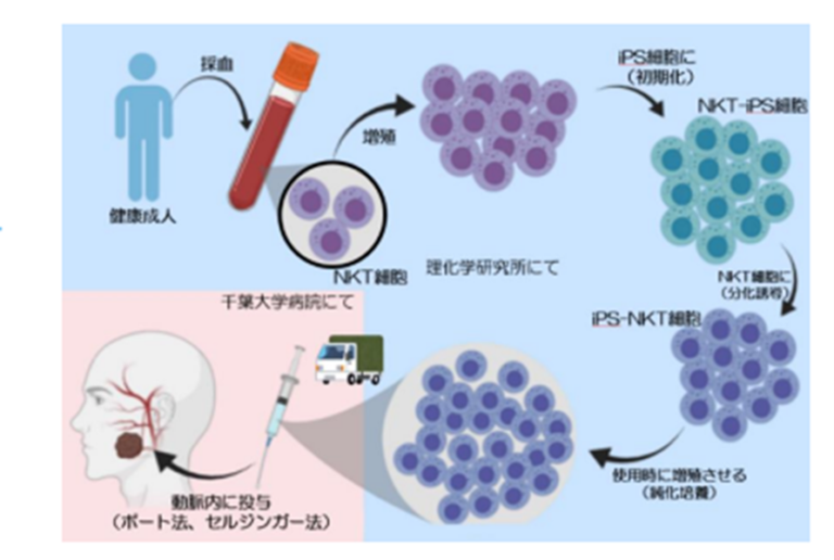 幹細胞ニュース｜iPSで国内初のがん治療、千葉大などが治験実施、移植成功 | 国際幹細胞普及機構