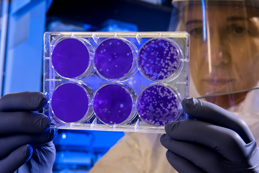 産総研とU-Factor、幹細胞培養上清液を用いた共同研究を開始