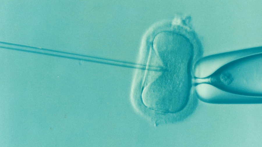 ヒト・サルの胎児卵巣から原始卵胞を体外で作出することに成功